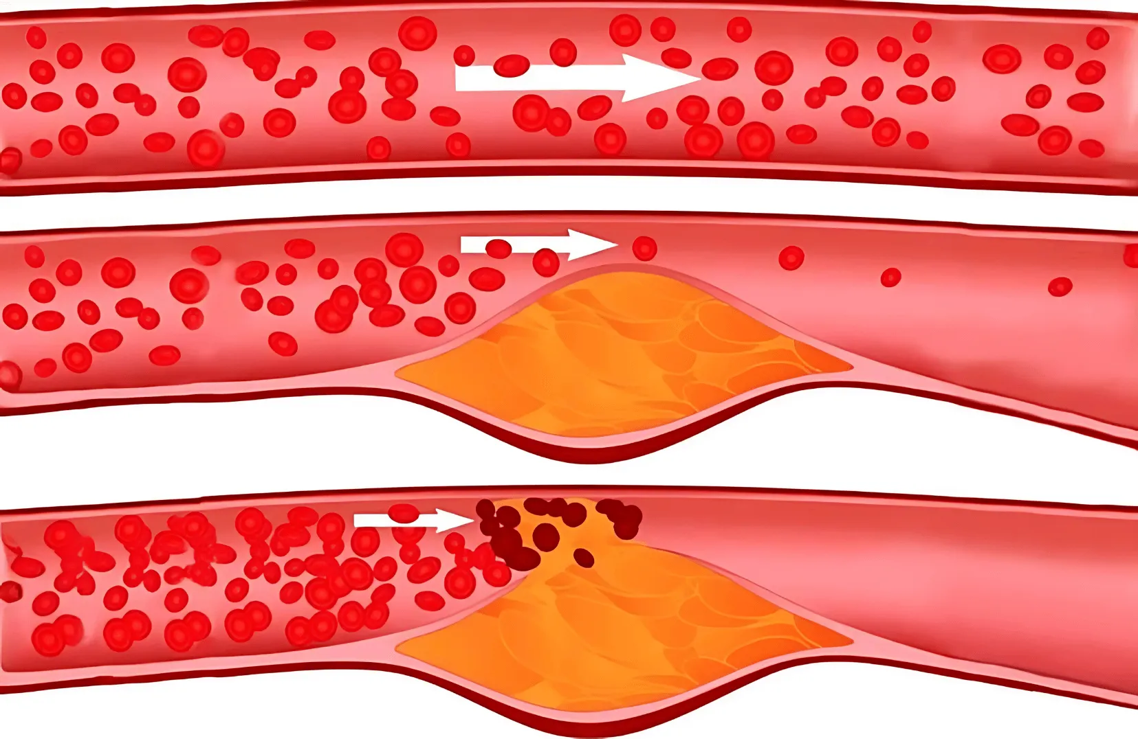 Illustration HerbaMax